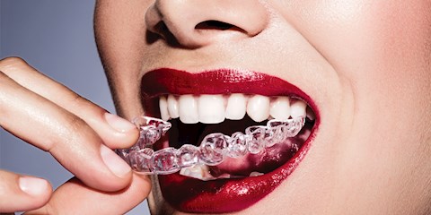 GÜLÜŞ ESTETİĞİ