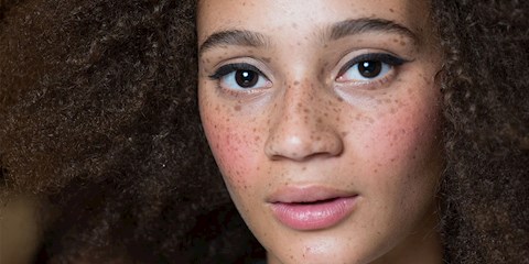 SİYAH NOKTALARA KARŞI MÜCADELE EDEN ÜRÜNLER