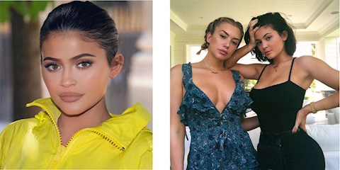 KYLIE JENNER’IN DUDAK DOLGULARI ARTIK YOK