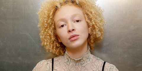 ELVEDA SİYAH NOKTALAR!