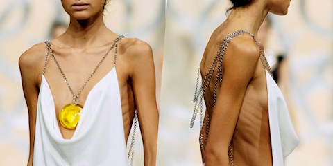 AŞIRI ZAYIF MODELLER FRANSA'DA YASAKLANDI